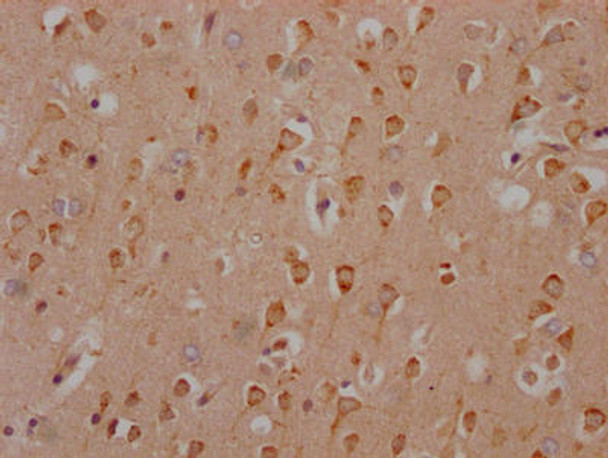 Anti-HTR2C Antibody (RACO0362)