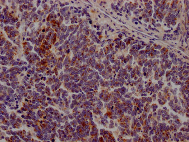 Anti-JAK3 Antibody (RACO0373)