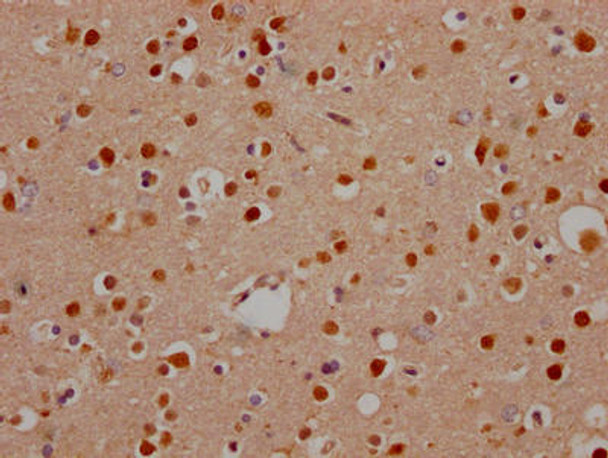 Anti-NOTCH1 Antibody (RACO0480)