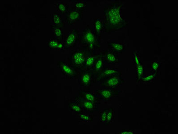 Anti-Phospho-RAF1 (S621) Antibody (RACO0102)