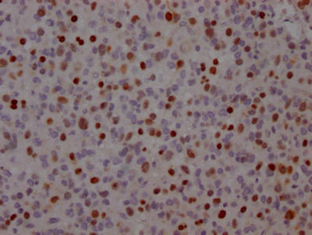 Anti-TP53 Antibody (RACO0310)