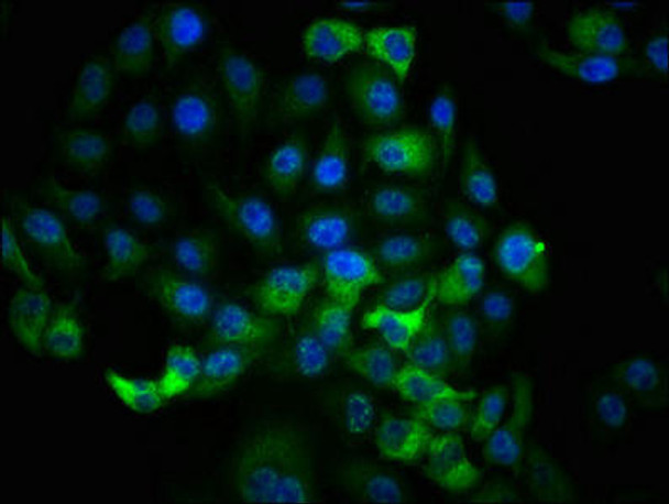 Anti-Phospho-RPS6KA1 (T359+S363) Antibody (RACO0049)