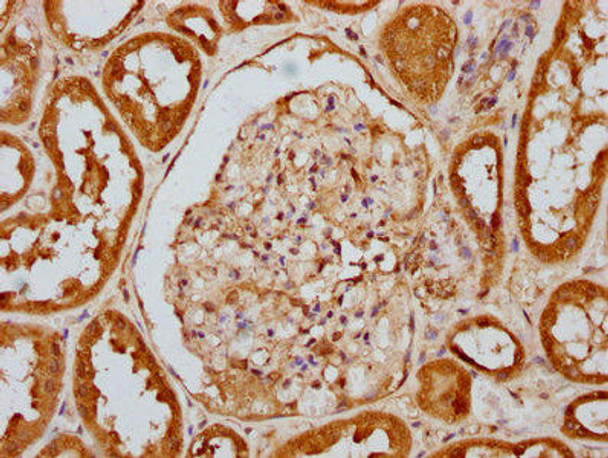 Anti-Phospho-EIF2AK2 (T446) Antibody (RACO0064)