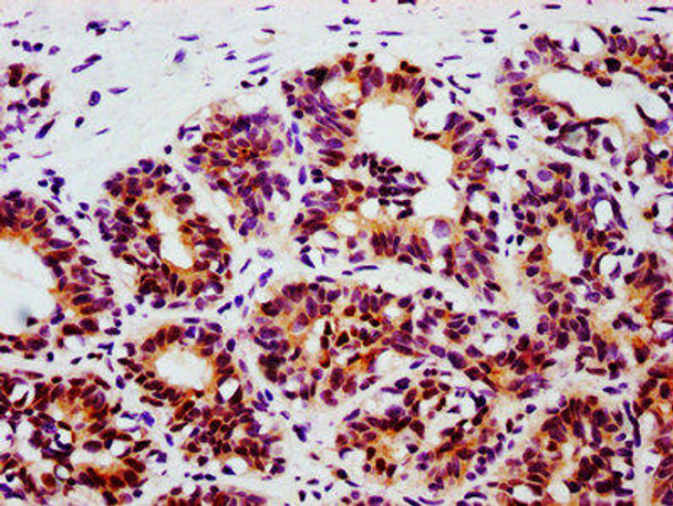 Anti-Phospho-STAT3 (Tyr705) Antibody (RACO0089)