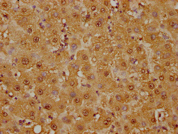 Anti-GSTO1 Antibody (RACO0155)