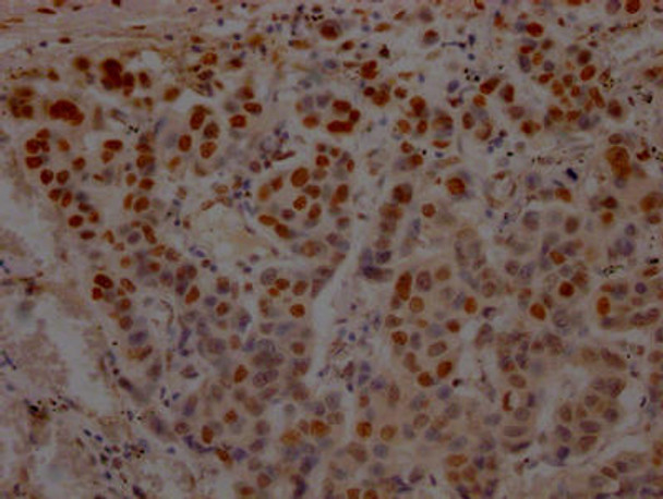 Anti-TP53 Antibody (RACO0555)