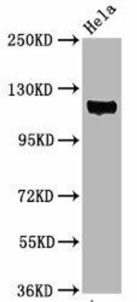 Anti-Phospho-PTK2 (Y397) Antibody (RACO0132)