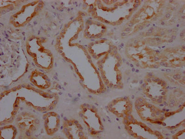 Anti-CASP3 Antibody (RACO0474)