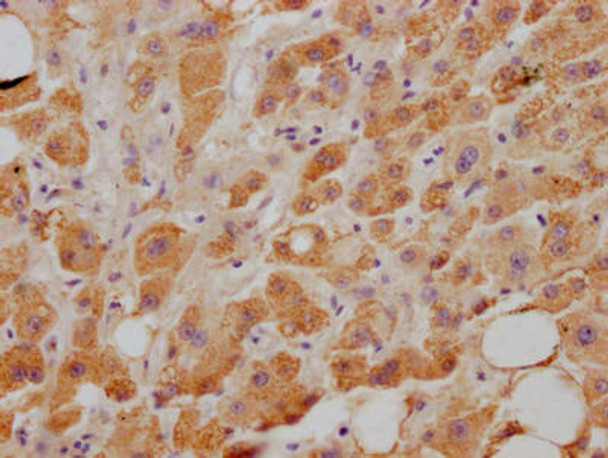 Anti-NPC1L1 Antibody (RACO0556)