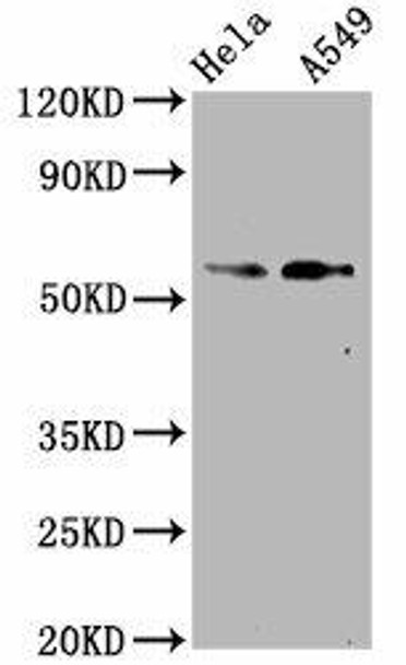 Anti-Phospho-SMAD2 (S250) Antibody (RACO0097)