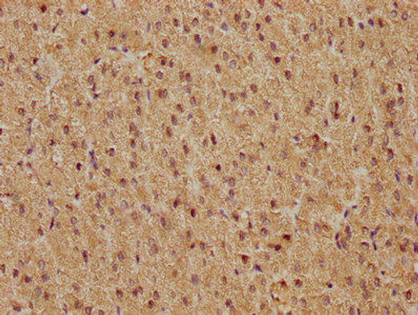 Anti-FOS Antibody (RACO0205)