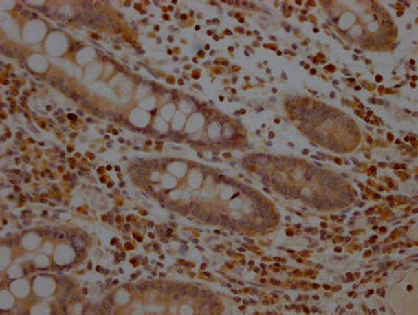 Anti-MAP2K1 Antibody (RACO0232)