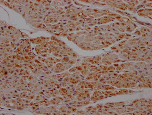 Anti-SDHB Antibody (RACO0342)