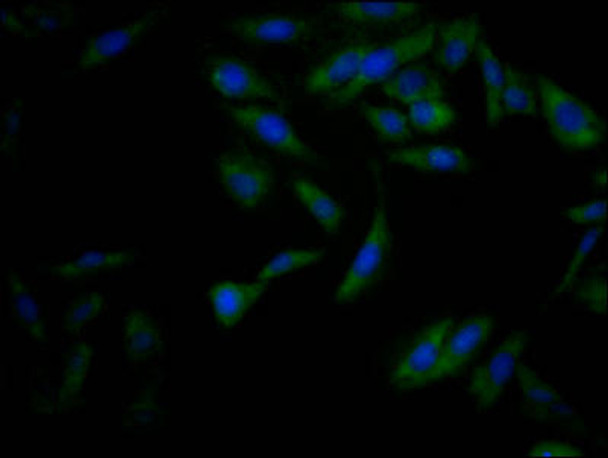 Anti-NFE2L2 Antibody (RACO0462)