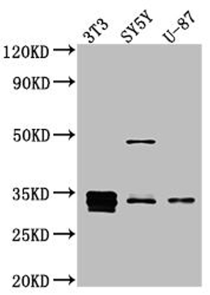 Anti-CCND1 Antibody (RACO0566)