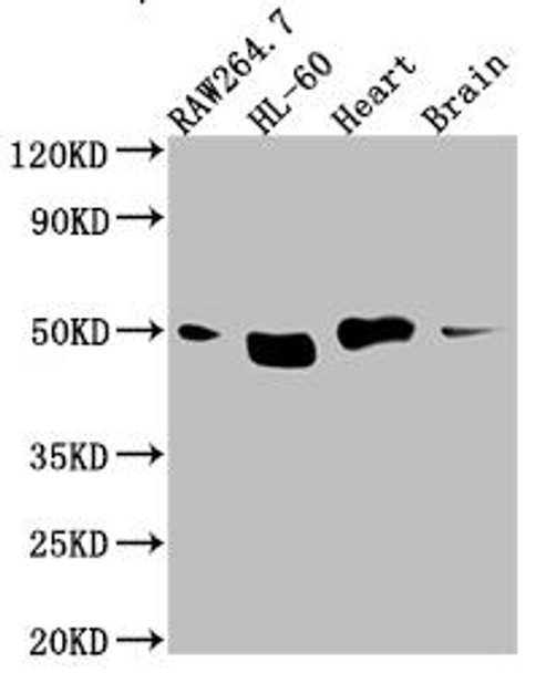 Anti-TINF2 Antibody (RACO0569)