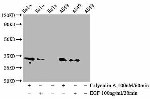 Anti-Phospho-CDK1/CDK2/CDK3 (T14) Antibody (RACO0094)