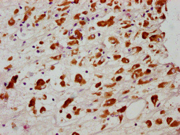 Anti-Phospho-MLKL (S358) Antibody (RACO0124)