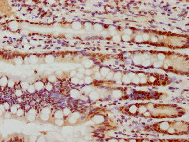 Anti-FEN1 Antibody (RACO0167)