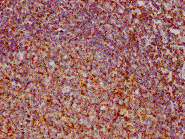 Anti-VDAC1 Antibody (RACO0177)