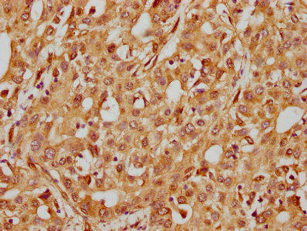 Anti-ITGB1 Antibody (RACO0197)