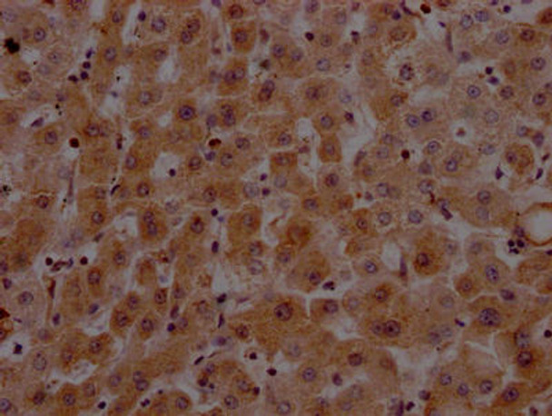 Anti-F2 Antibody (RACO0355)
