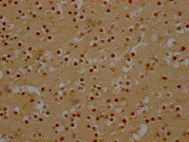 Anti-DDX6 Antibody (RACO0494)