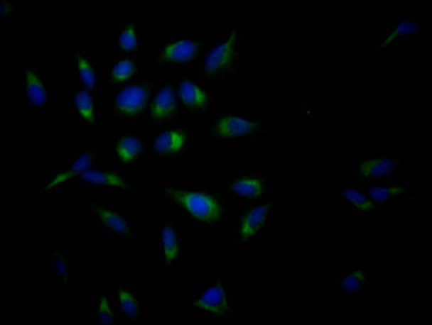 Anti-APP Antibody (RACO0496)