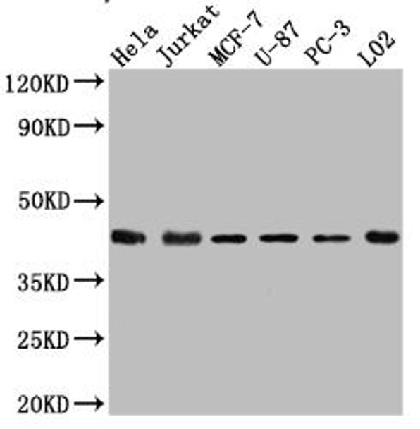 Anti-MAPK14 Antibody (RACO0498)