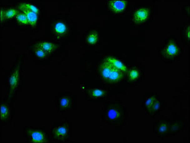 Anti-CASP9 Antibody (RACO0158)