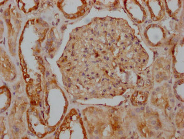 Anti-ITGAV Antibody (RACO0241)