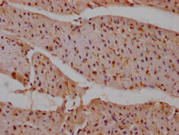 Anti-PTPN11 Antibody (RACO0257)