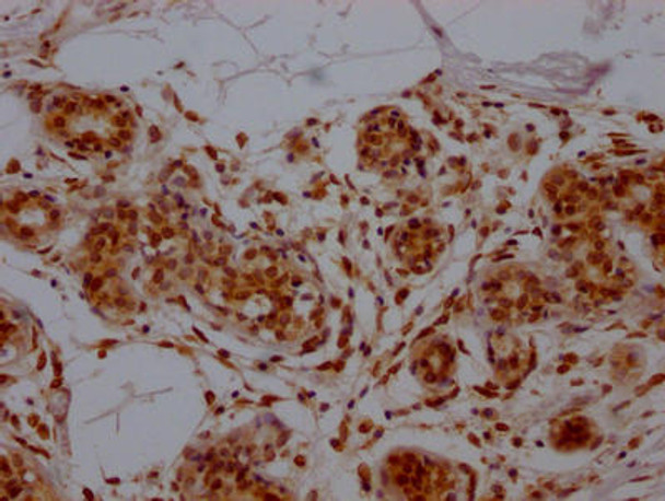 Anti-E2F1 Antibody (RACO0294)