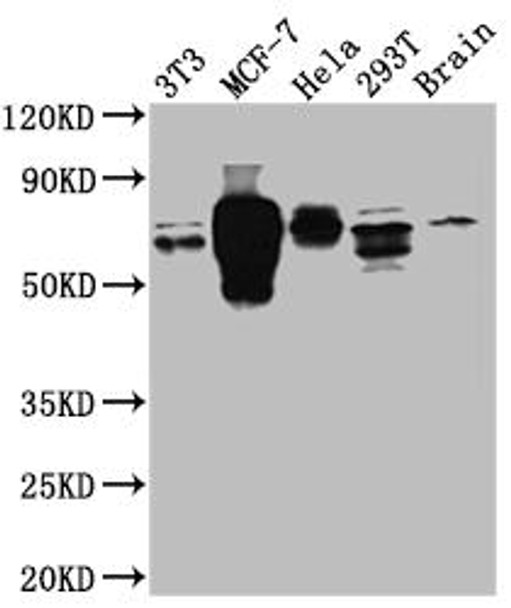 Anti-RPS6KB1 Antibody (RACO0458)