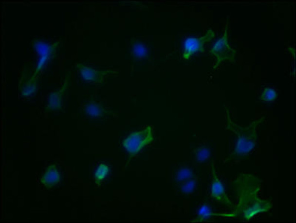 Anti-AURKA Antibody (RACO0218)