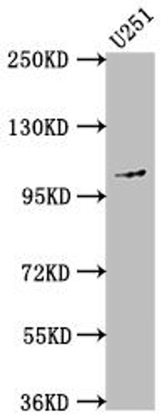 Anti-MME Antibody (RACO0264)