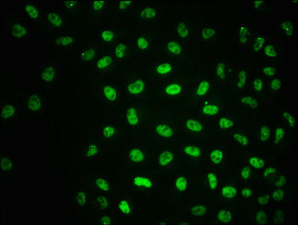 Anti-Phospho-ATM (S1981) Antibody (RACO0120)