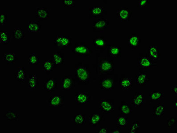 Anti-Phospho-PRKDC (S2056) Antibody (RACO0128)