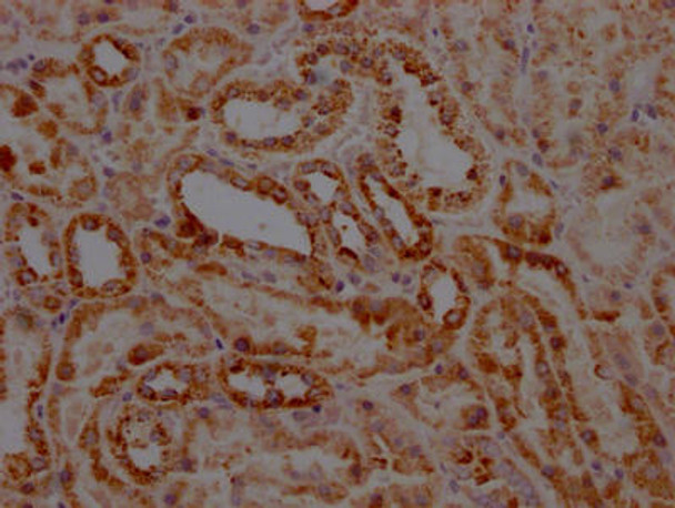 Anti-STAT6 Antibody (RACO0544)