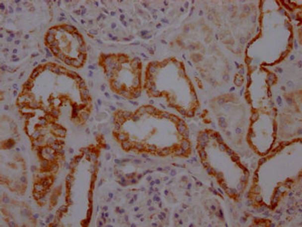 Anti-TOMM22 Antibody (RACO0581)