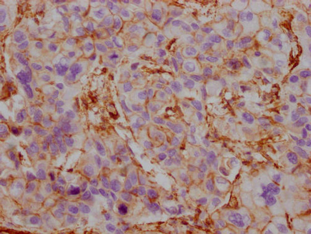 Anti-ACTB/POTEKP/ACTG1 Antibody (MACO0470)