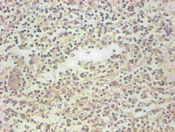 Anti-LCN2 Antibody (MACO0544)