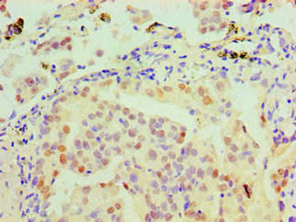 Anti-MSH6 Antibody (MACO0563)