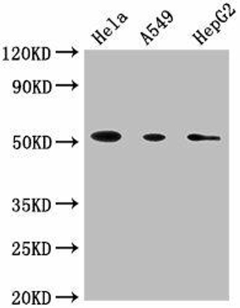 Anti-CD14 Antibody (MACO0614)