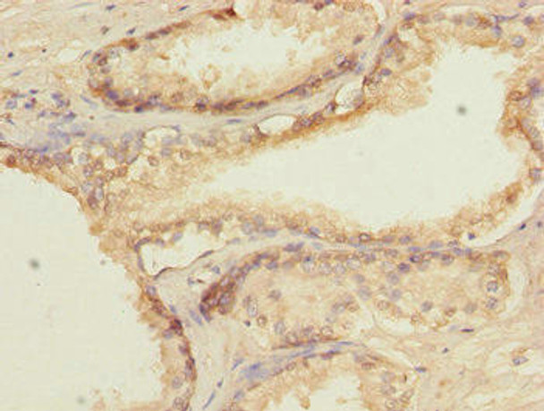 GTF2A2 Antibody (PACO44643)