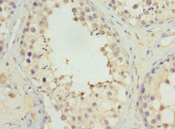 UGT3A2 Antibody (PACO44808)