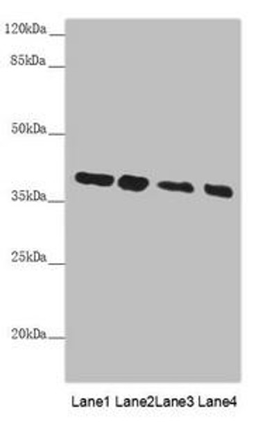 PPP1R8 Antibody (PACO44921)