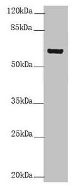 KRT6B Antibody (PACO44946)