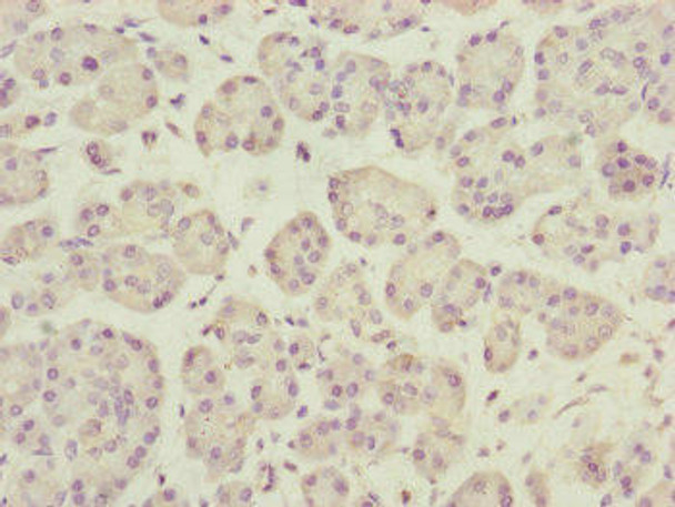 DCTN3 Antibody (PACO45070)
