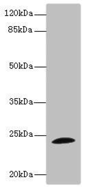 TPPP Antibody (PACO45277)